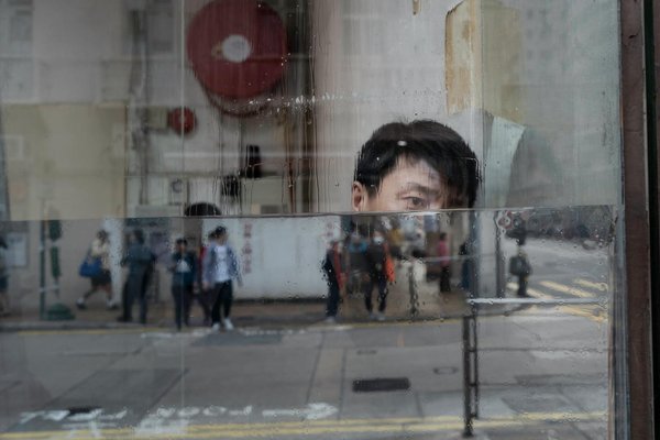 Stampa 3D e Protesi Ortopediche Su Misura: La Rivoluzione del Futuro Medico